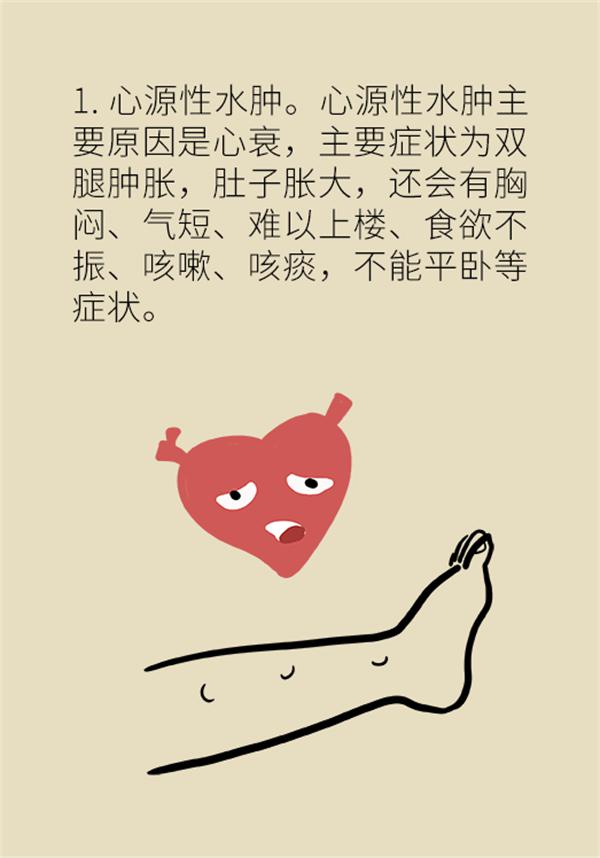 身体出现水肿需要做哪些检查,身体出现水肿吃什么药好