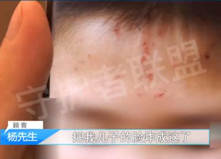 男童拆冰淇淋蛋糕被干冰炸伤，商家：我们不承担任何责任！网友疑惑，干冰究竟为何会爆炸？