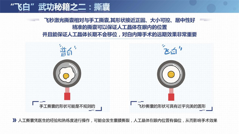飞秒激光白内障老年人能不能做,第六人民医院飞秒白内障手术