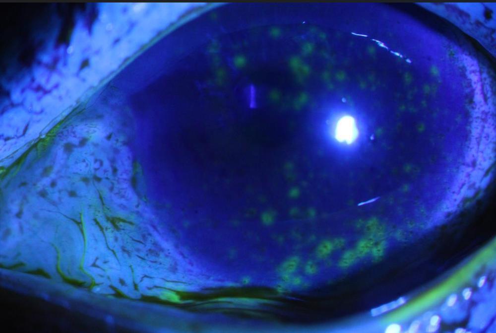 自己在家染发如何保护眼睛,染发真的会伤害眼睛吗