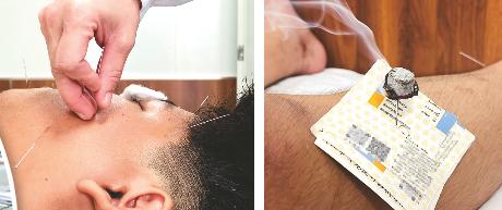 夏天谨防风扇直吹导致面瘫,夏天吹风扇或空调怎么避免面瘫