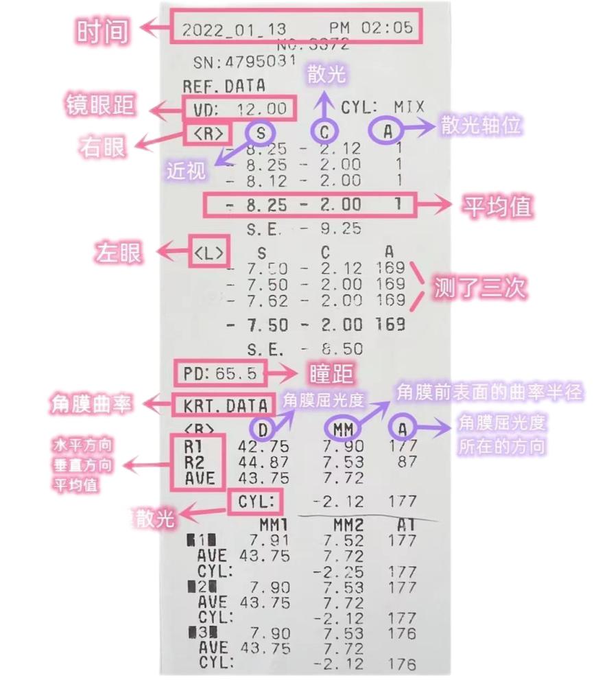 医生解读视力检查表上的常见指标,儿童视力报告单数值怎么看